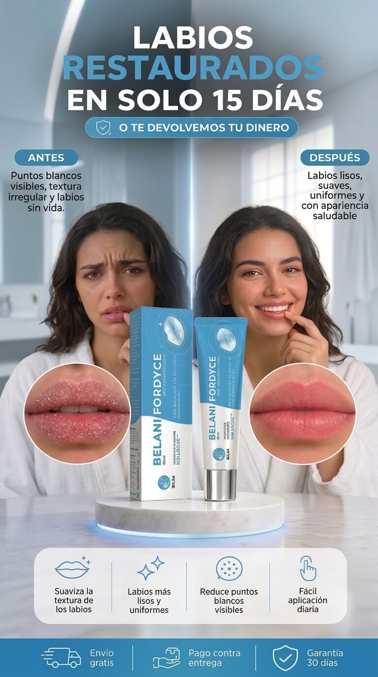 Belani Fordyce : Dile adios a las manchas en tus labios