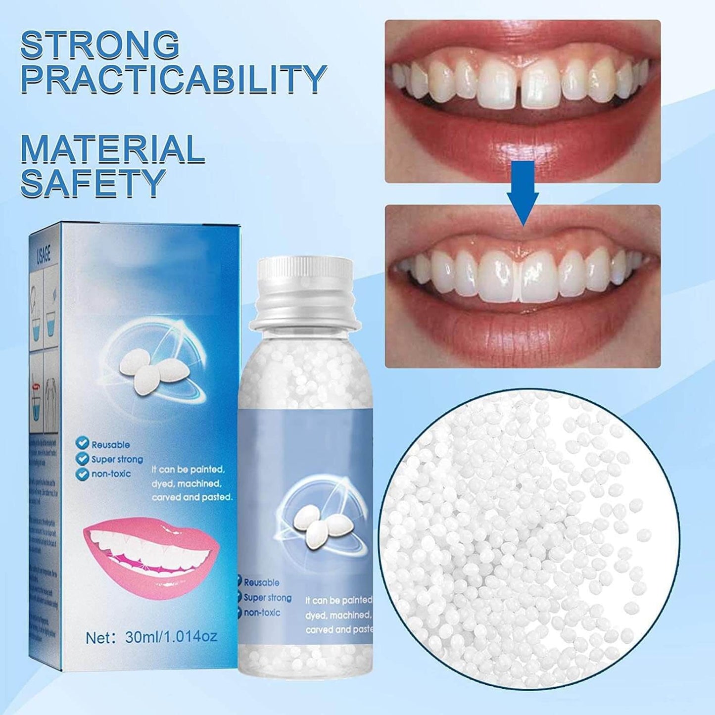 Kit de Reparación Dental Profesional