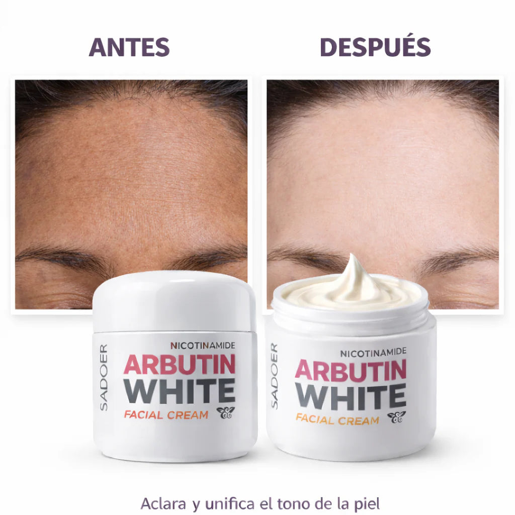 Crema Aclarante Arbutin White con Nicotinamida