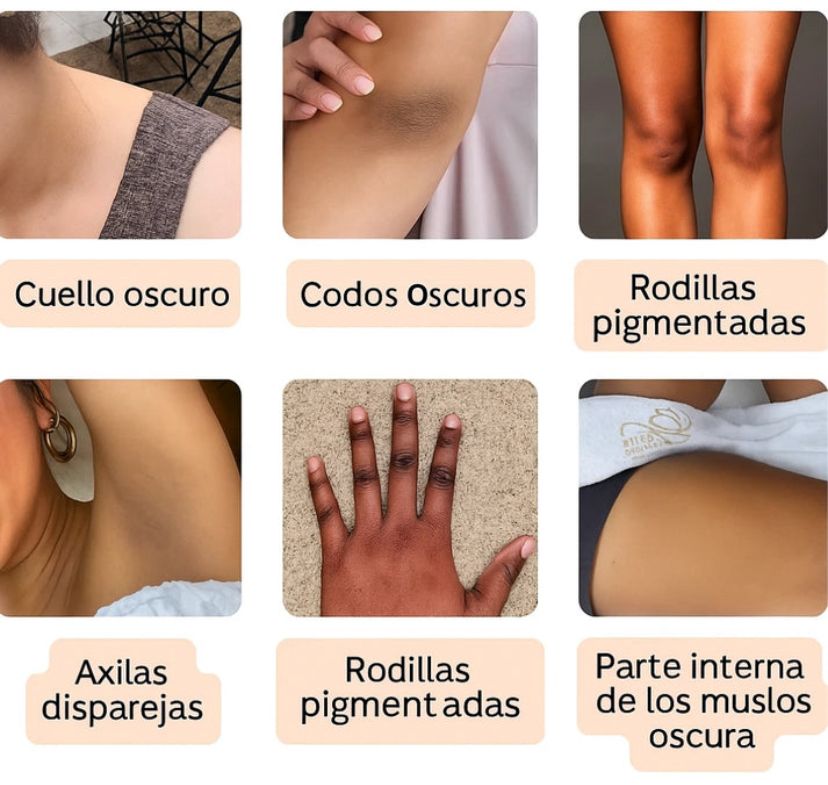 DrMelaxin Peel Shot – Aclara zonas oscuras y elimina manchas